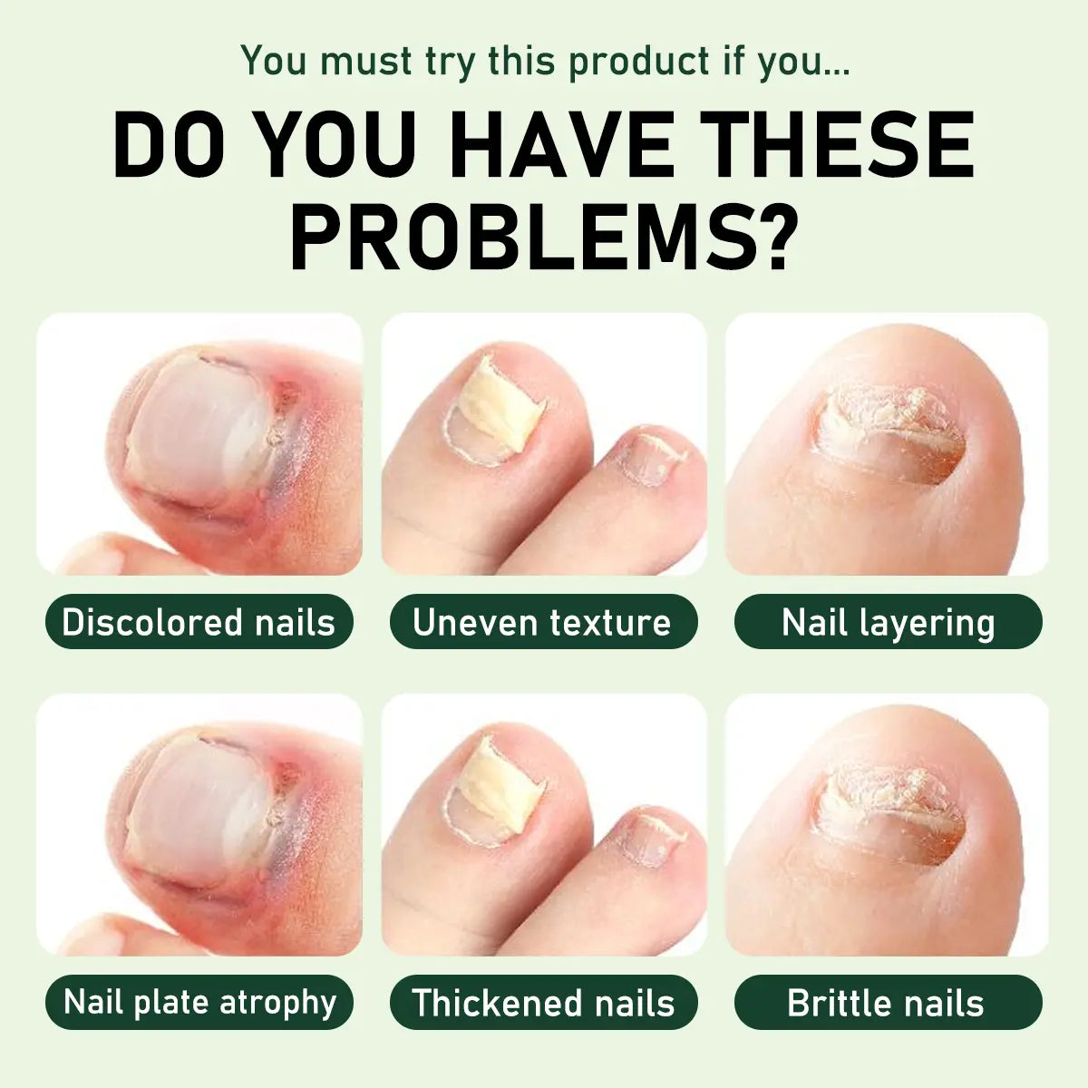 Umex® 7-Day Nail Revive Serum