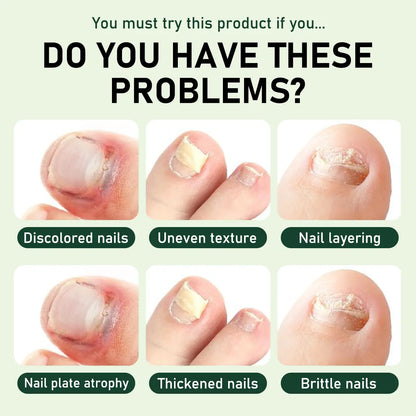 Umex® 7-Day Nail Revive Serum