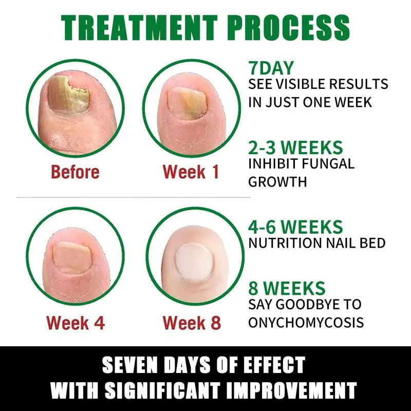Umex® 7-Day Nail Revive Serum